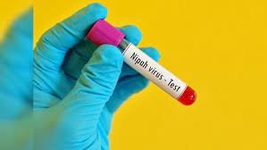 Nipah virus vaccine trials