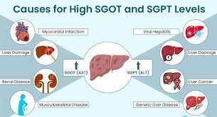 SGPT full form in medical