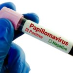 indigenous HPV test validation