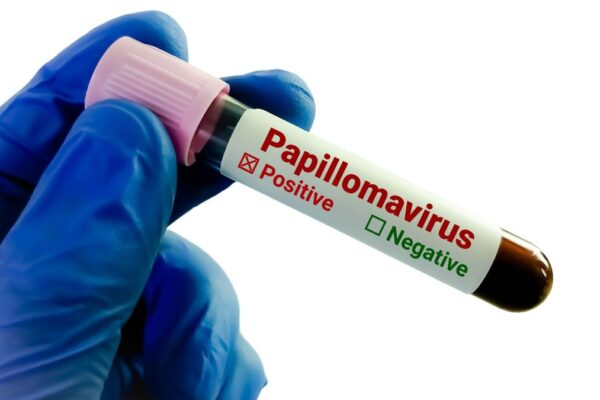 indigenous HPV test validation