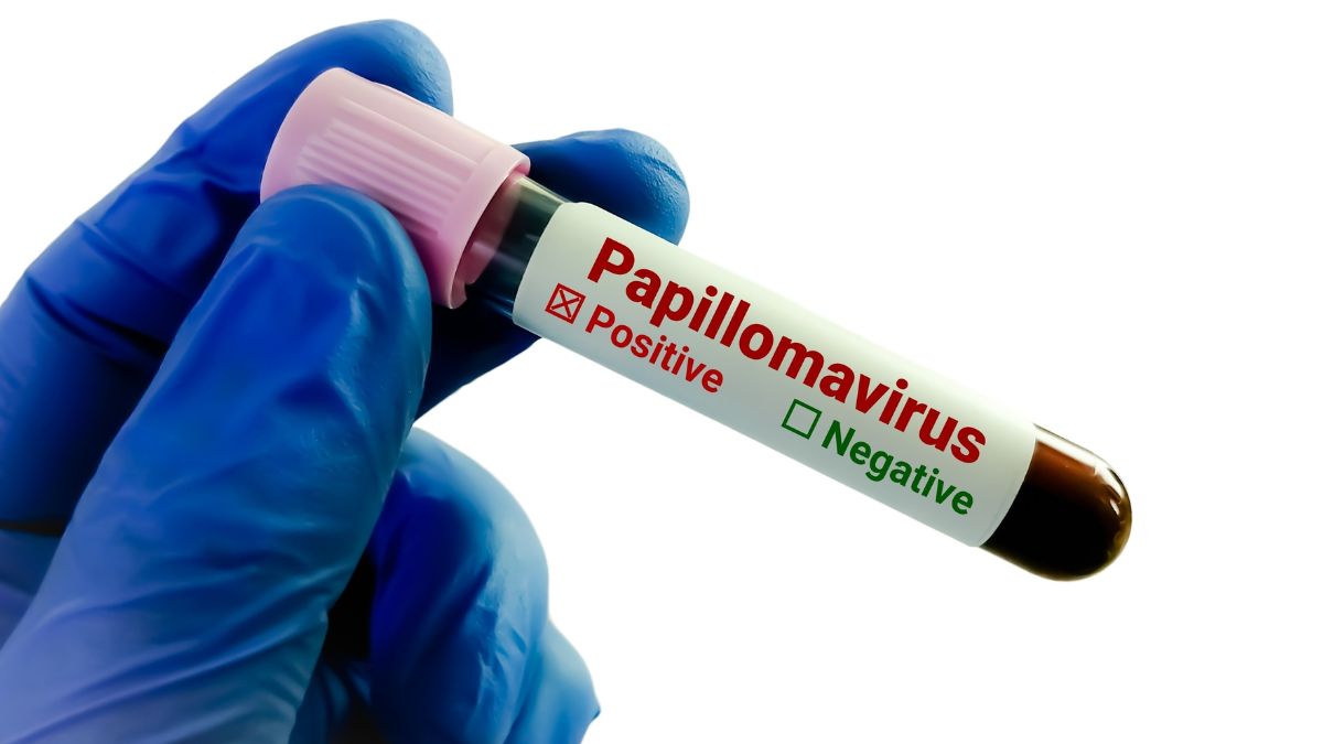 indigenous HPV test validation
